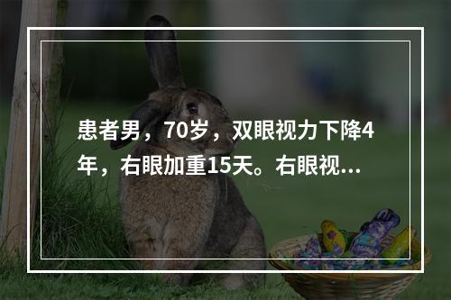 患者男，70岁，双眼视力下降4年，右眼加重15天。右眼视力指