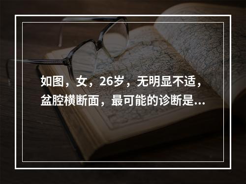 如图，女，26岁，无明显不适，盆腔横断面，最可能的诊断是（