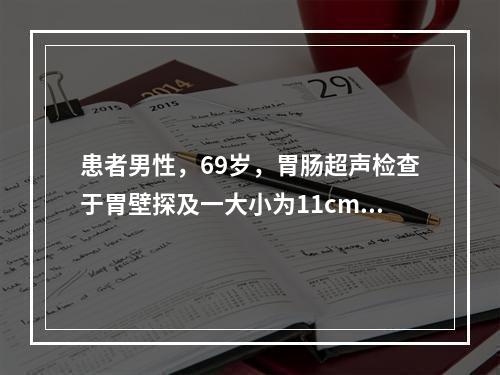 患者男性，69岁，胃肠超声检查于胃壁探及一大小为11cm×