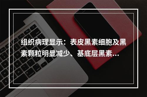 组织病理显示：表皮黑素细胞及黑素颗粒明显减少、基底层黑素细胞