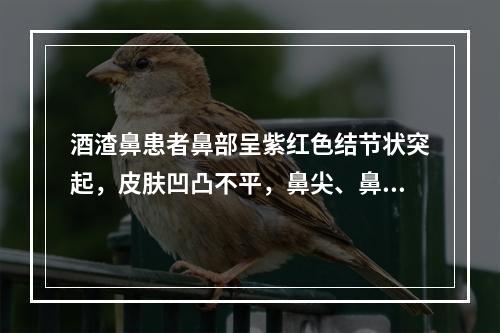 酒渣鼻患者鼻部呈紫红色结节状突起，皮肤凹凸不平，鼻尖、鼻翼肥