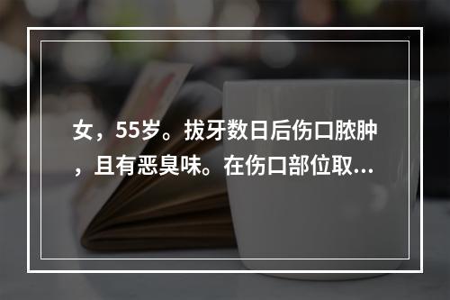 女，55岁。拔牙数日后伤口脓肿，且有恶臭味。在伤口部位取材，