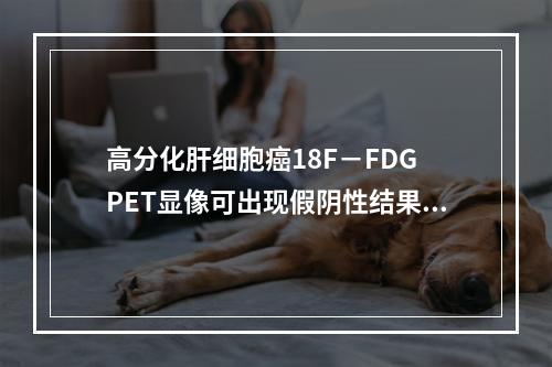 高分化肝细胞癌18F－FDG PET显像可出现假阴性结果，