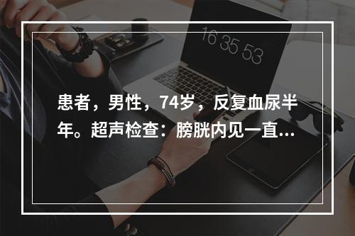 患者，男性，74岁，反复血尿半年。超声检查：膀胱内见一直径