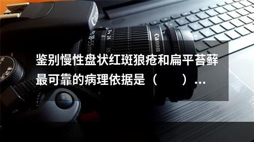 鉴别慢性盘状红斑狼疮和扁平苔藓最可靠的病理依据是（　　）。