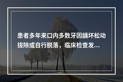 患者多年来口内多数牙因龋坏松动拔除或自行脱落，临床检查发现：