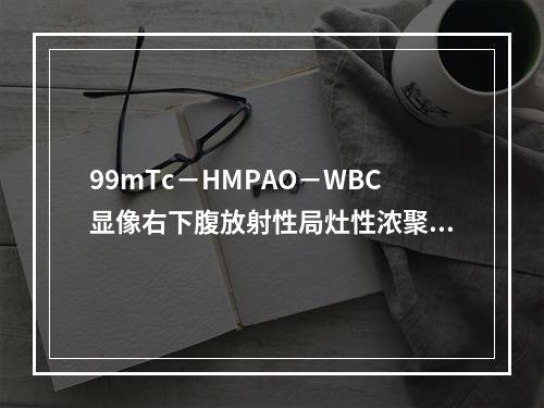 99mTc－HMPAO－WBC显像右下腹放射性局灶性浓聚影，