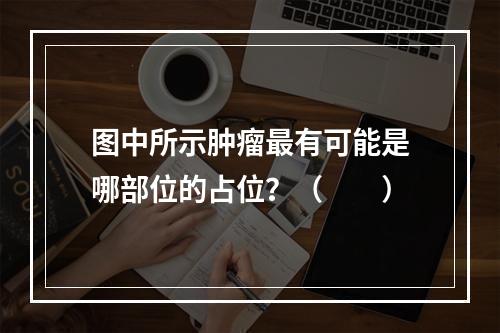 图中所示肿瘤最有可能是哪部位的占位？（　　）