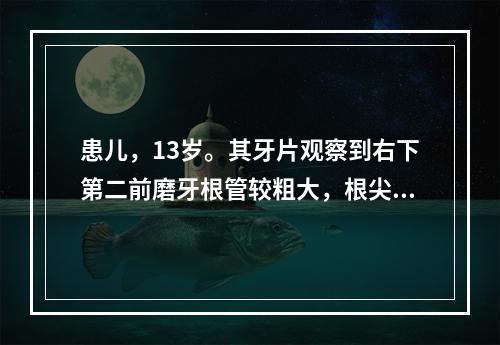 患儿，13岁。其牙片观察到右下第二前磨牙根管较粗大，根尖处有