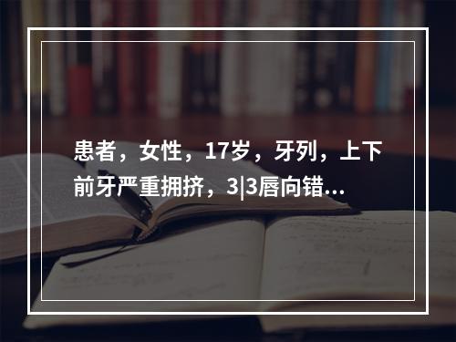 患者，女性，17岁，牙列，上下前牙严重拥挤，3|3唇向错位，