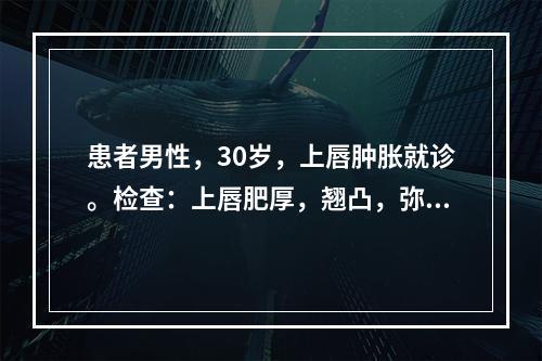 患者男性，30岁，上唇肿胀就诊。检查：上唇肥厚，翘凸，弥散性