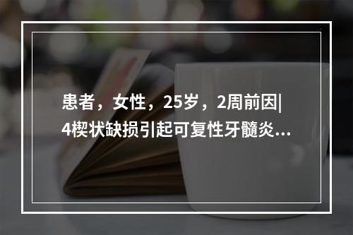 患者，女性，25岁，2周前因|4楔状缺损引起可复性牙髓炎来院