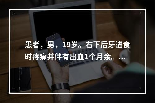 患者，男，19岁。右下后牙进食时疼痛并伴有出血1个月余。检查