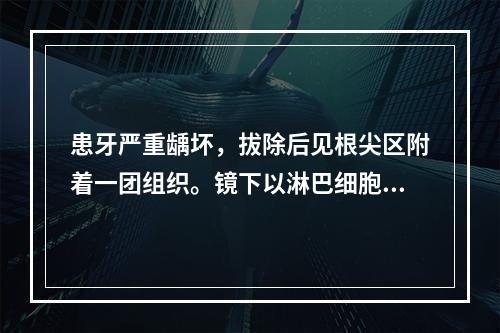 患牙严重龋坏，拔除后见根尖区附着一团组织。镜下以淋巴细胞、浆