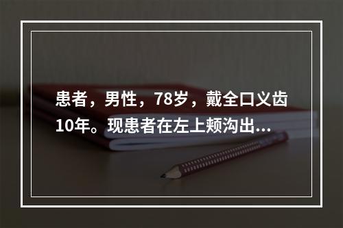 患者，男性，78岁，戴全口义齿10年。现患者在左上颊沟出现一