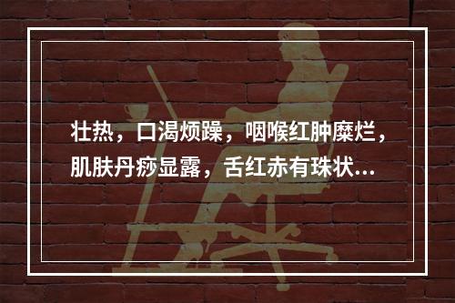 壮热，口渴烦躁，咽喉红肿糜烂，肌肤丹痧显露，舌红赤有珠状物