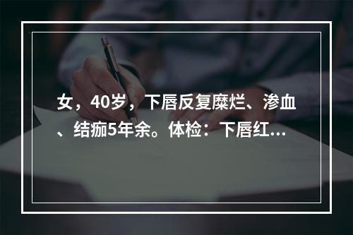 女，40岁，下唇反复糜烂、渗血、结痂5年余。体检：下唇红椭圆