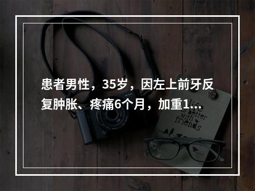 患者男性，35岁，因左上前牙反复肿胀、疼痛6个月，加重1周