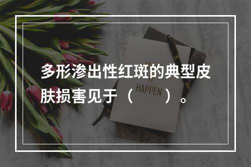 多形渗出性红斑的典型皮肤损害见于（　　）。