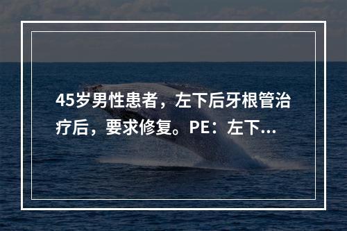 45岁男性患者，左下后牙根管治疗后，要求修复。PE：左下6残