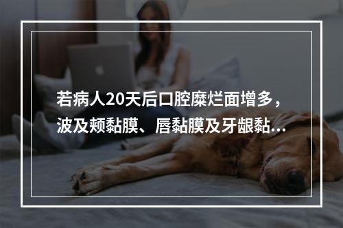 若病人20天后口腔糜烂面增多，波及颊黏膜、唇黏膜及牙龈黏膜，