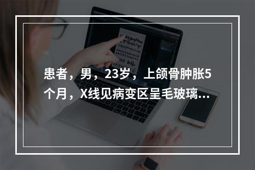 患者，男，23岁，上颌骨肿胀5个月，X线见病变区呈毛玻璃状，