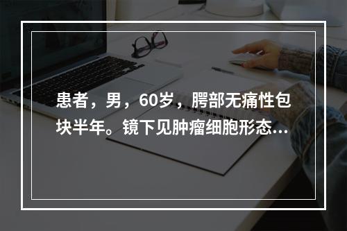 患者，男，60岁，腭部无痛性包块半年。镜下见肿瘤细胞形态一致