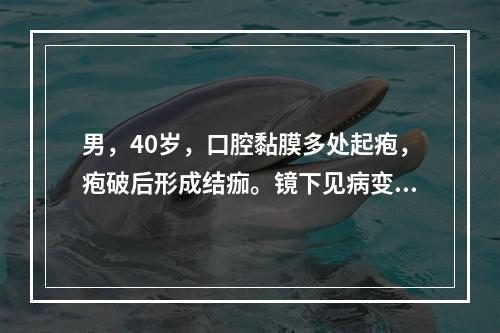 男，40岁，口腔黏膜多处起疱，疱破后形成结痂。镜下见病变浅层