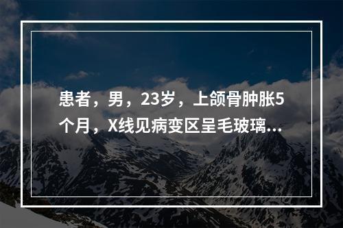 患者，男，23岁，上颌骨肿胀5个月，X线见病变区呈毛玻璃状，