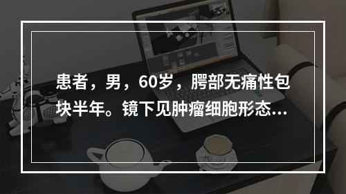 患者，男，60岁，腭部无痛性包块半年。镜下见肿瘤细胞形态一致