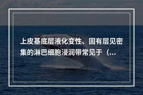 上皮基底层液化变性、固有层见密集的淋巴细胞浸润带常见于（　　