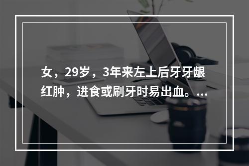 女，29岁，3年来左上后牙牙龈红肿，进食或刷牙时易出血。近日