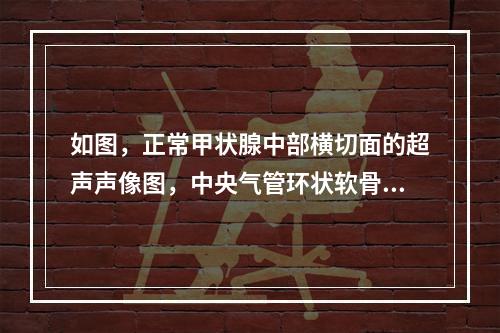 如图，正常甲状腺中部横切面的超声声像图，中央气管环状软骨前