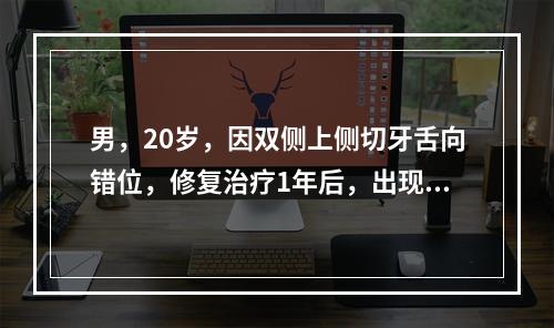 男，20岁，因双侧上侧切牙舌向错位，修复治疗1年后，出现上前