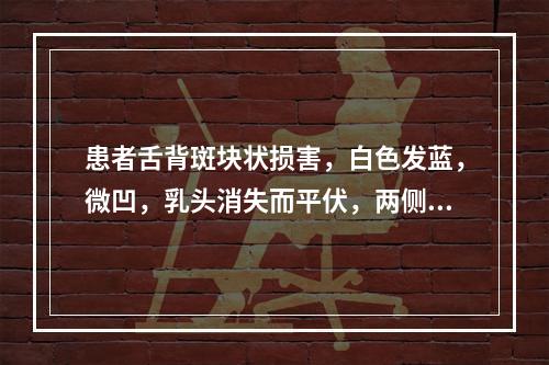 患者舌背斑块状损害，白色发蓝，微凹，乳头消失而平伏，两侧基本