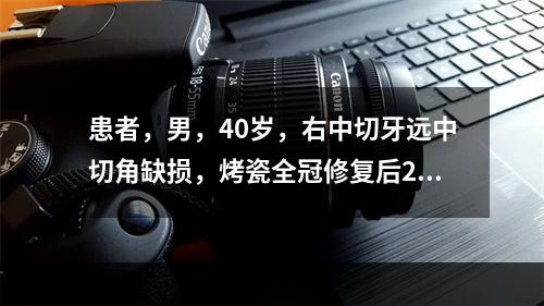 患者，男，40岁，右中切牙远中切角缺损，烤瓷全冠修复后2日，