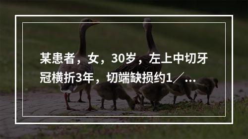 某患者，女，30岁，左上中切牙冠横折3年，切端缺损约1／4，