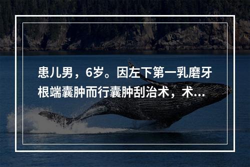 患儿男，6岁。因左下第一乳磨牙根端囊肿而行囊肿刮治术，术后出