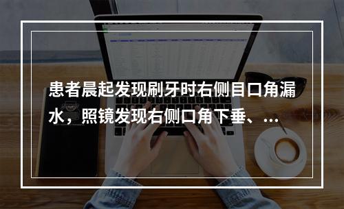 患者晨起发现刷牙时右侧目口角漏水，照镜发现右侧口角下垂、眼睑