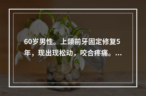 60岁男性。上颌前牙固定修复5年，现出现松动，咬合疼痛。口腔