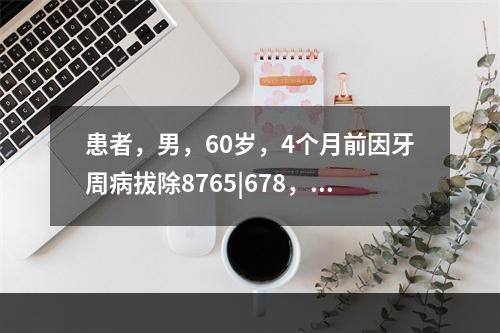 患者，男，60岁，4个月前因牙周病拔除8765|678，余留