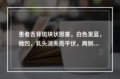 患者舌背斑块状损害，白色发蓝，微凹，乳头消失而平伏，两侧基本