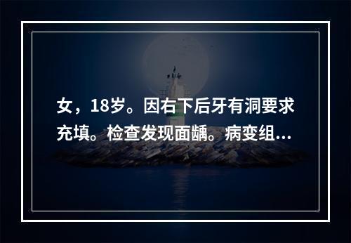 女，18岁。因右下后牙有洞要求充填。检查发现面龋。病变组织颜