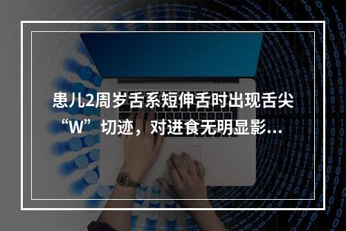 患儿2周岁舌系短伸舌时出现舌尖“W”切迹，对进食无明显影响，