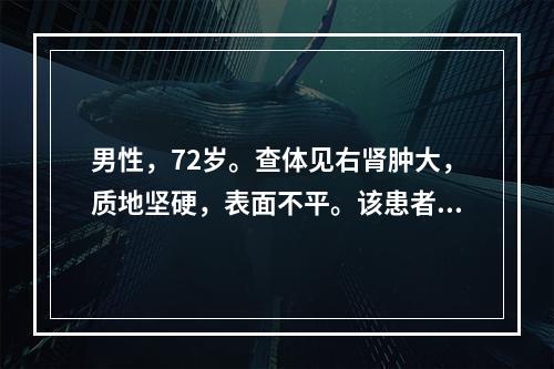 男性，72岁。查体见右肾肿大，质地坚硬，表面不平。该患者可能