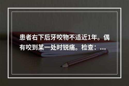 患者右下后牙咬物不适近1年。偶有咬到某一处时锐痛。检查：右下