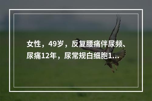 女性，49岁，反复腰痛伴尿频、尿痛12年，尿常规白细胞10