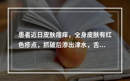 患者近日皮肤瘙痒，全身皮肤有红色疹点，抓破后渗出津水，舌苔薄