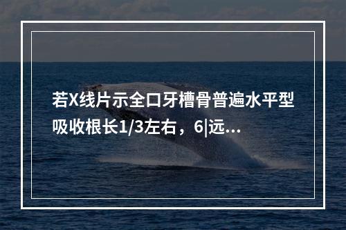 若X线片示全口牙槽骨普遍水平型吸收根长1/3左右，6|远中根