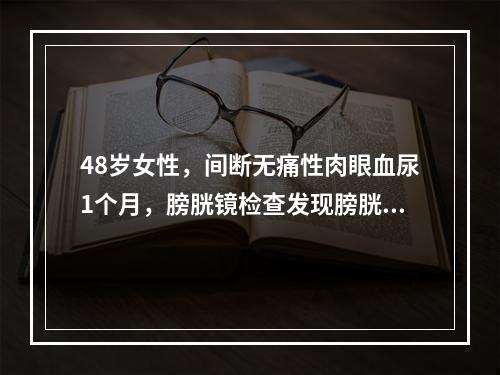 48岁女性，间断无痛性肉眼血尿1个月，膀胱镜检查发现膀胱左后